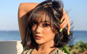 Marion Jola Pamer Dada 'Digigit Nyamuk', Betis Berotot dan Poni Acak-Acakan Dipuji Seksi