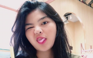 Rosa Meldianti Live Instagram, Gigi Miring Karena Behel Jadi Sorotan
