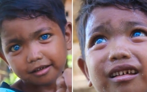Bocah Asal Sulawesi Ini Bikin Heboh Karena Bermata Biru Indah bak Permata, Netter Puji Habis-Habisan