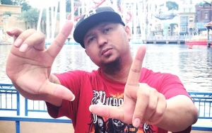Sutradara Anggy Umbara Patah Tulang Usai Kecelakaan Sepeda, Diprediksi Baru Bisa Jalan 6 Bulan Lagi
