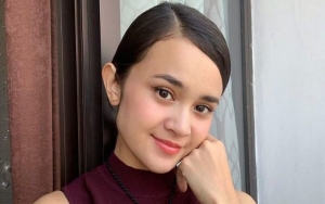 Direstui Jadi Calon Istri Rizky Nazar, Michelle Ziudith Dikritik Akibat Umbar Bagian Tubuh Ini