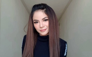 Dinar Candy Pakai Make-Up Bak Topeng Hingga Jidat Belang Bikin Salfok