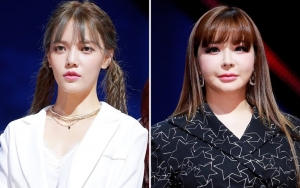 Jimin AOA Tuai Pro Kontra Usai Tuding Park Bom Diperlakukan Istimewa di 'Queendom'