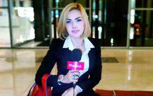 Barbie Kumalasari Pamer Lesung Pipi Baru Tiru Meldi Diledek Makin Aneh