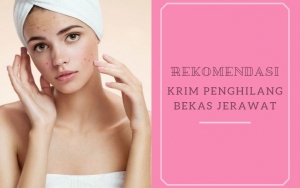 Dijual dengan Harga Terjangkau, Ini 8 Krim Penghilang Bekas Jerawat yang Berkualitas Baik