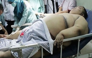 Ini Permintaan Terakhir Bocah Obesitas Karawang Dengan Berat 110 Kg Sebelum Meninggal