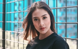  Anya Geraldine Pajang Foto Cantik Malah Dikira Panuan Hingga Kudisan, Gara-Gara Jarang Mandi?