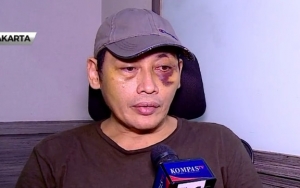 Tersangka Penyekapan Ninoy Karundeng Ungkap Sosok 'Habib' Dalam Kasusnya
