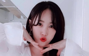 Sempat Dikira Netizen Operasi Platik, Begini Penjelasan Byul