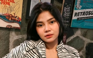 Penjelasan Rosa Meldianti Soal Biaya Fantastis Untuk Perawatan Tuai Komentar Tak Terduga