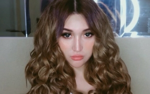 Lucinta Luna Kembali Eksis Usai Kecelakaan dan Dituding Implan Jidat, Begini Penampilannya Sekarang