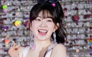 Wajah Cantik Irene Red Velvet Trending, Ternyata Paling Populer di Klinik Operasi Plastik