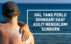 Sering Dianggap Sepele, 7 Hal Ini Perlu Kalian Hindari Saat Kulit Mengalami Sunburn!