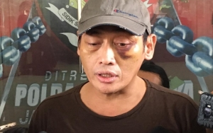Meski Sudah Maafkan Tersangka, Ninoy Karundeng Tetap Lanjut Proses Hukum