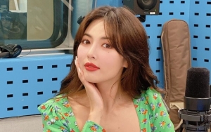 Punya Imej Seksi, HyunA Ungkap Seperti Apa Kepribadian Aslinya