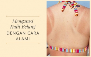 Bebas Bahan Kimia, Ikuti 7 Tips Ini Untuk Mengatasi Kulit Belang Dengan Cara Alami