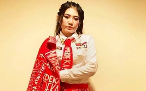 Via Vallen Buka Suara Soal Tudingan Penampilan Berubah Gara-Gara Operasi Plastik