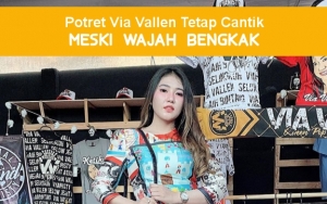 8 Potret Via Vallen yang Tetap Cantik Meski Wajah Bengkak, Bukan Gara-Gara Operasi Plastik Loh!