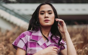 Sheryl Sheinafia Alami Cedera Tangan Akibat Jatuh dari Panggung Usai Lakukan Ini