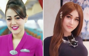 Puteri Novita Kalah Cantik dari Lucinta Luna, Harga Oplas di Jepang dan London Super Mahal?