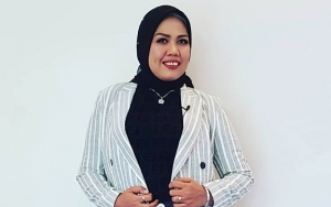 Ely Sugigi Dipuji Makin Cantik Setelah Rapikan Gigi Hingga Terima Julukan Baru