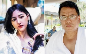 Siwi Diisukan Pernah Nikahi Bule, Reaksi Hotman Paris Menohok Soal Hasil Oplas