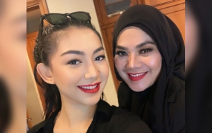 Keaslian Hidung Putri Sulung Diragukan, Reaksi Sarita Abdul Mukti Bikin Adem