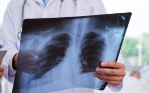Heboh Wabah Pneumonia Misterius di Tiongkok, Begini Kata Kemenkes