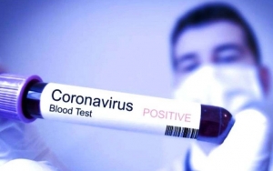 Orang-Orang Ini Memiliki Kemungkinan Lebih Besar Tertular Virus Corona