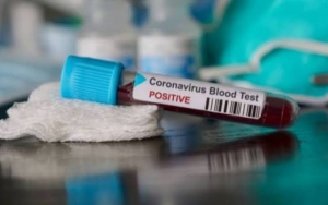 Teori Konspirasi Virus Corona 'Menjamur', Usaha Twitter Melawan