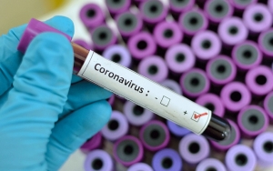 Guru Besar Unair Ungkap Jamu Sederhana Untuk Tangkal Virus Corona