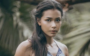 Jadi Duta 'Help Them To See', Adinia Wirasti Daftarkan Diri Jadi Calon Pendonor Kornea