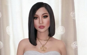 Derita Dysphoria Gender, Kisah Pilu Lucinta Luna Belah Kepala Hingga Punya 7 Nama Terkuak