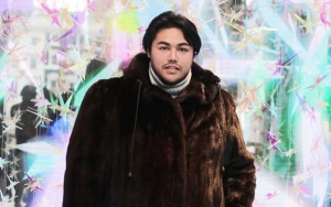 Habis Puluhan Juta, Ivan Gunawan Malah Gatal-Gatal Setelah Pakai Skincare dari Korea