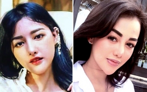 Saingi Siwi, Putri Ramli Terduga Gundik Oplas Bibir Montok Tiru Lucinta Luna?