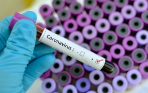 Diplomat AS Sampaikan Keprihatinan Soal Penanganan Virus Corona di Indonesia