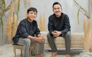 Betrand Peto Tetap Manggung Meski Pipi Berdarah Usai Dicakar Fans, Ruben Onsu Geram?