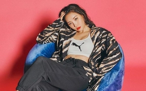 Dahi Jenong Sunmi Dicurigai Hasil Oplas, Netizen Beri Komentar Sadis