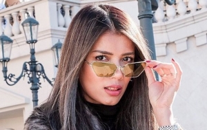 Sabrina Chairunnisa Geram Usai Dituding Lakukan Operasi Plastik, Ungkap Fakta Sebenarnya
