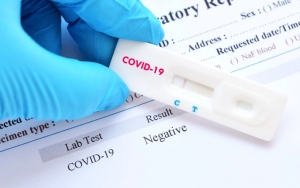 Indonesia Lakukan Rapid Test Untuk Deteksi Corona, Apa Beda Dengan Tes Sebelumnya?
