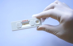 Ini Kata Pakar Soal Pengadaan Rapid Test Massal Virus Corona
