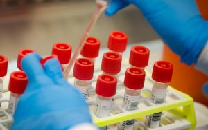 Utamakan Rakyat, 3 Fraksi Partai Ini Kompak Tolak Tegas Rapid Test Corona Anggota DPR 