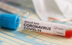 Jokowi Perintahkan Rapid Test Deteksi Corona, Malaysia Justru Larang Warganya