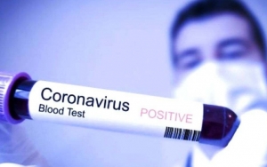 Mutasi Virus Corona Bikin Banyak Orang Resah, Ini Kata Ahli