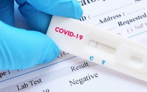 Singapura Kembangkan Test Kit COVID-19 Baru, 5 Menit Langsung Keluar Hasilnya