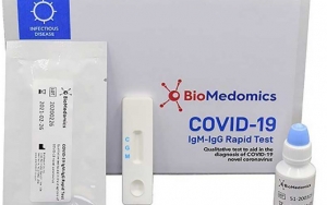 Kalbar Siap Lakukan Rapid Test COVID-19, Prioritaskan 2 Golongan Ini Karena Jumlah Terbatas