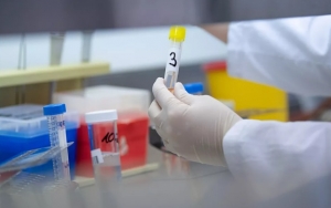 WHO Pilih Malaysia Sebagai Lokasi Uji Coba Obat Corona