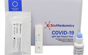 Rapid Test Covid-19 Pakai Serum di Jakarta Bikin Kemungkinan Positif Lebih Tinggi, Ini Alasannya