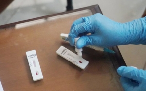 Kemenkes RI: Rapid Test Antibodi yang Sudah Dibagikan Itu Validitasnya Memang Kurang