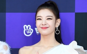 Lia ITZY Gagal Keren di Panggung Gara-Gara Gigi 'Ompong'